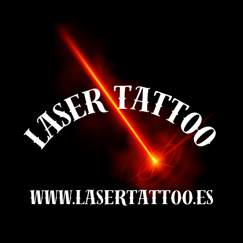 laser tattoo